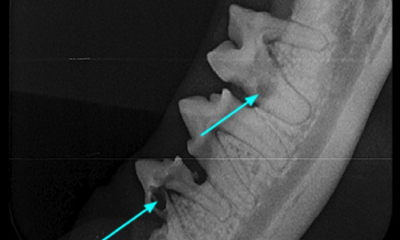 dental x-ray lesions
