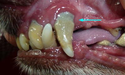 Gum recession root exposure