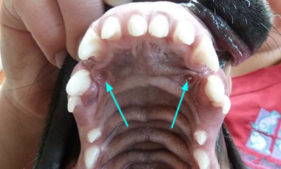 palate contact points