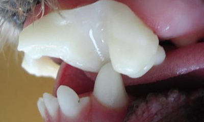 Ortodontia de Plano Inclinado