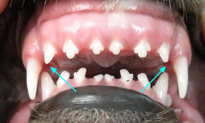 Overbite palate contact