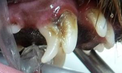Tartar accumulation and gingivitis 