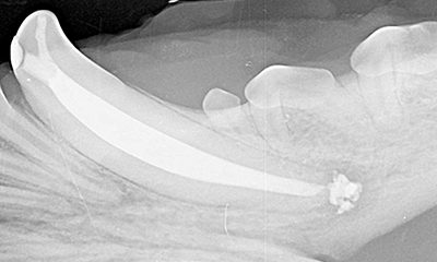root canal therapy dental x-ray