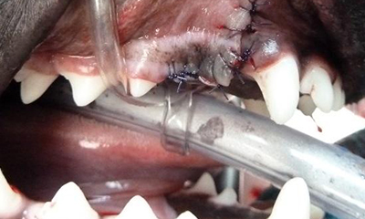 surgical extraction of fractured tooth