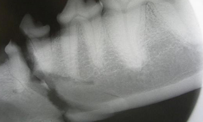 dental x-ray jaw fracture