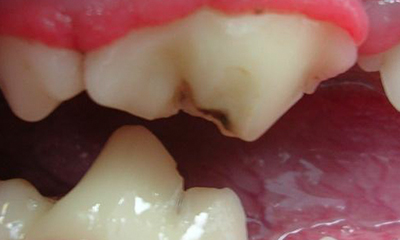 worn tooth premolor