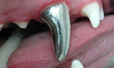 crown for worn tooth