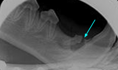 dental x-ray cyst
