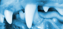 misaligned teeth overbite