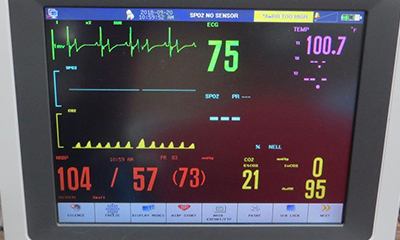 Multi-parameter anesthetics monitor