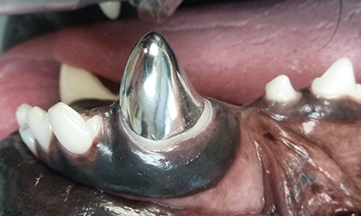 titanium crown lower canine