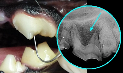 dental x-ray fracture root infection
