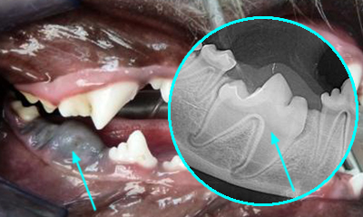 dental x-ray impacted molar