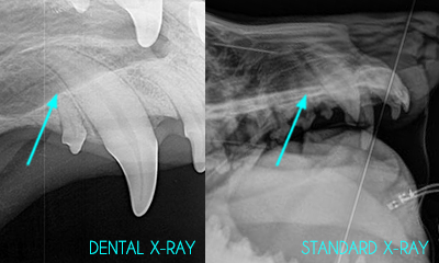 Dental x-ray compared to standard x-ray