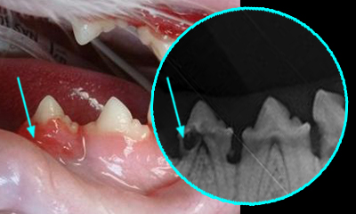 dental x-ray tooth resorption