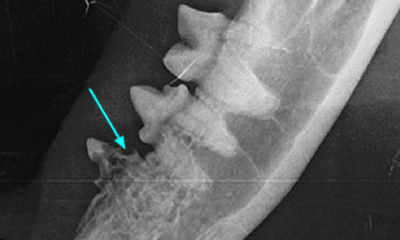 Dental x-ray root resorption.