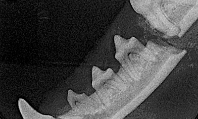 dental x-ray jaw fracture
