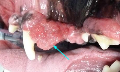 oral tumor lower jaw