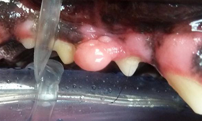 oral mass upper premolar
