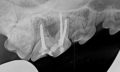 dental x-ray root canal therapy