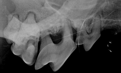 dental x-ray bone loss