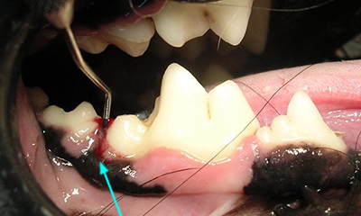 Perda óssea de bolsa periodontal